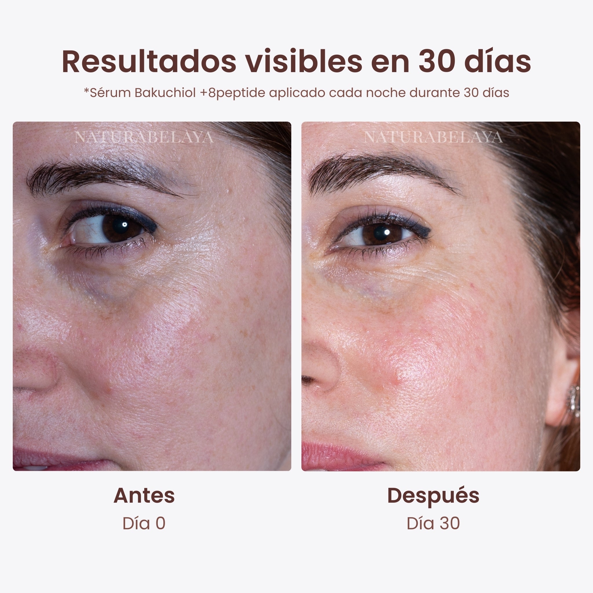 Serum de noche antiarrugas despigmentante Bakuchiol + 8Peptide